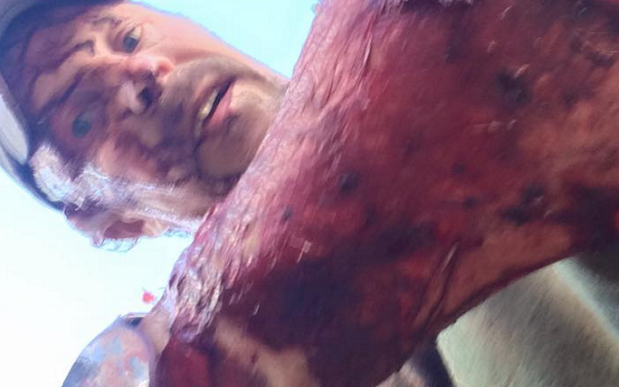 todd-orr-bear-attacks-1