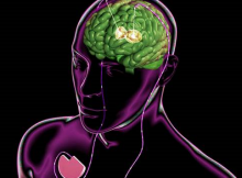 Huntington’s disease