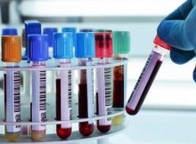 blood test for brain injury diagnosis