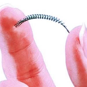 fda curbs essure sales