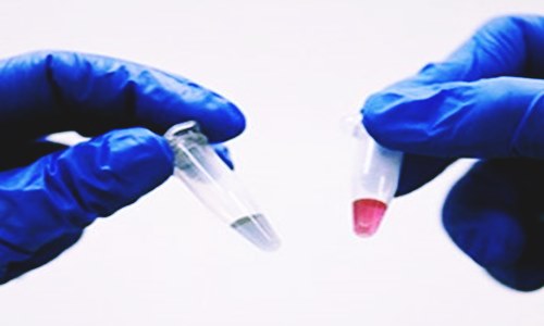 Australian Researchers Develop A 10 Minute Test For Cancer Detection